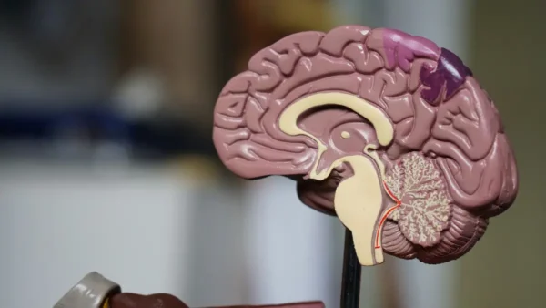 Image of a brain