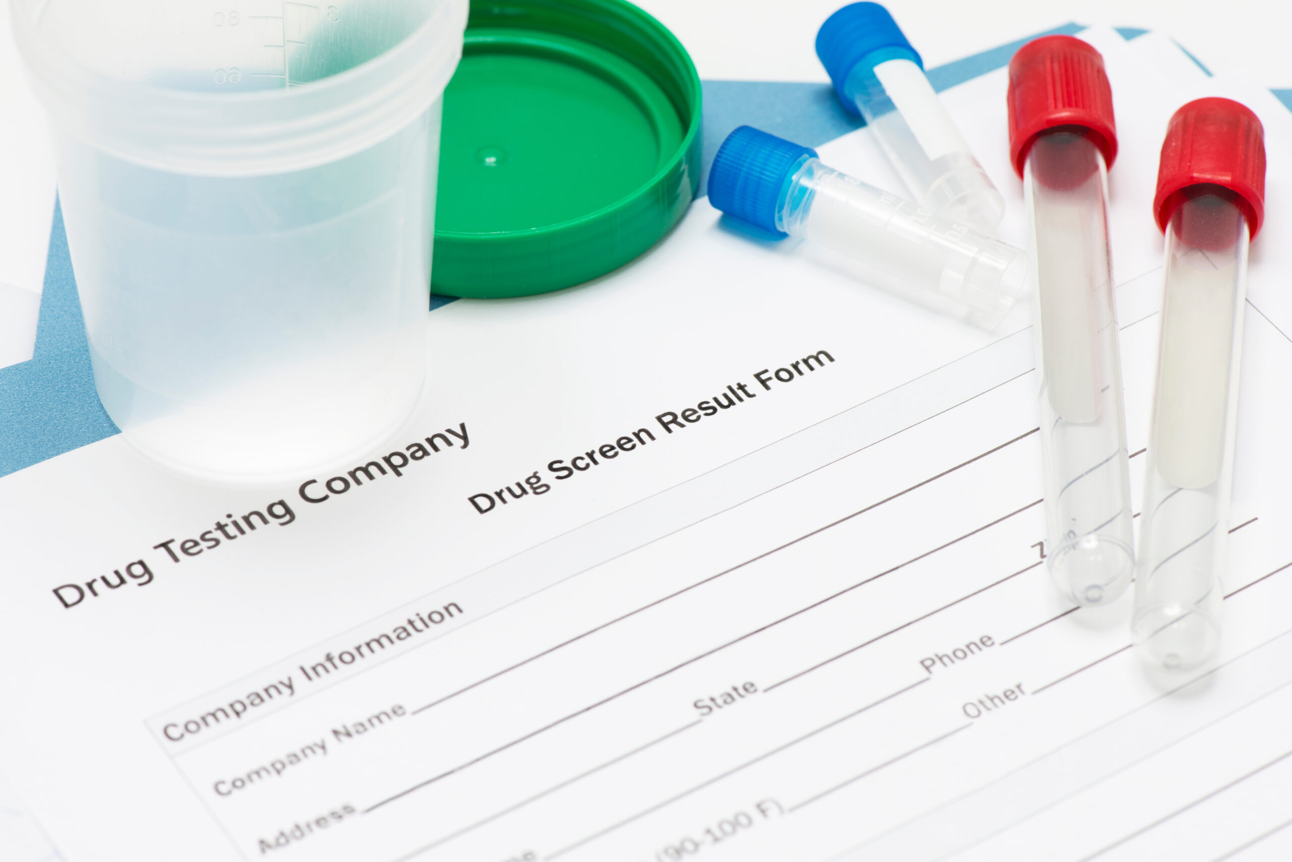 You are currently viewing Does Haas Drug Test?